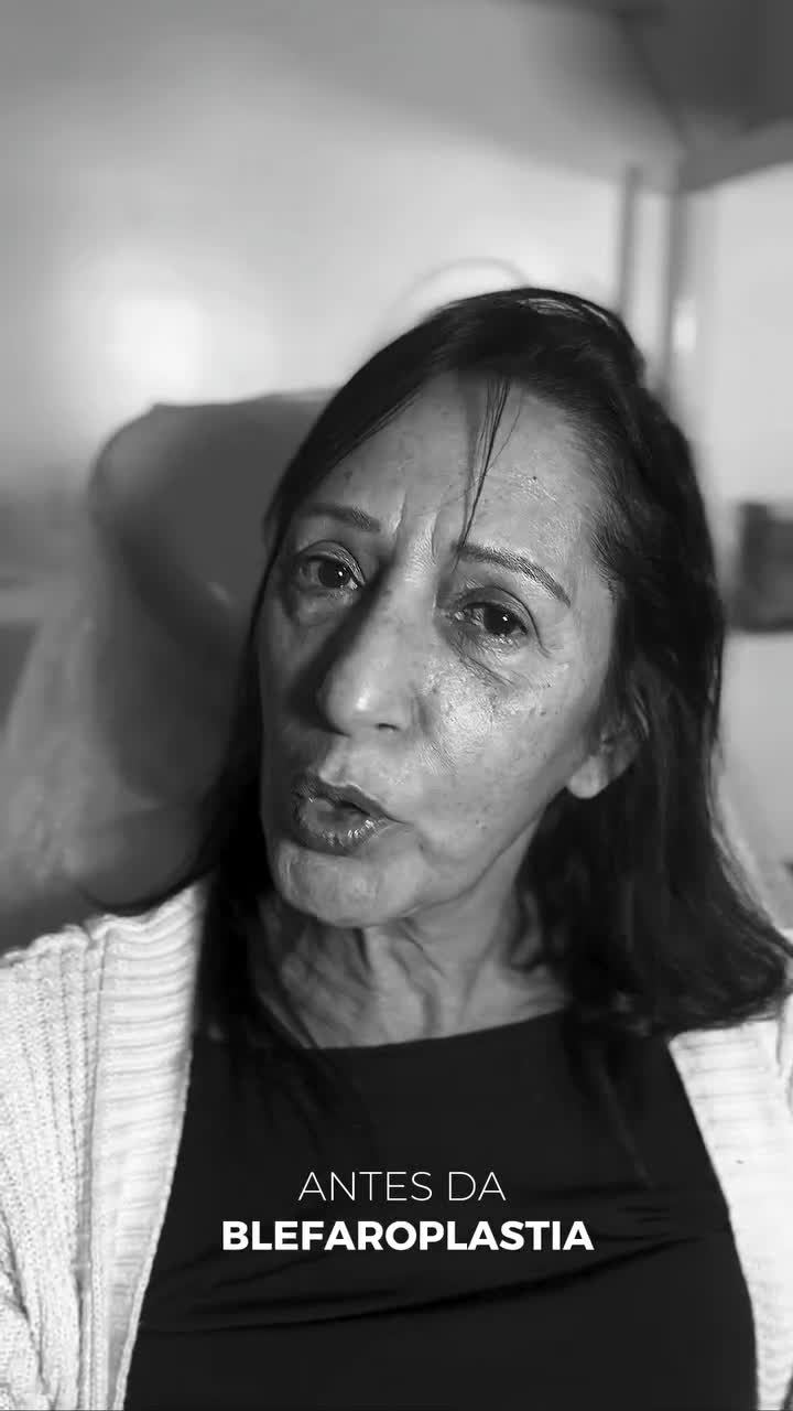 Relato em vídeo 02 - Antes da Blefaroplastia